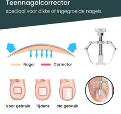 7-Delige Pedicure Set - Nagelverzorging - Nagelset Starterset - Ingegroeide Teennagel - Kalknagelproducten - Pedicuresets - RVS 17 7-Delige Pedicure Set - Nagelverzorging - Nagelset Starterset - Ingegroeide Teennagel - Kalknagelproducten - Pedicuresets - RVS -Cosmetica Serie Winkel 1200x1130 15