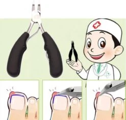 Professionele Nagelschaar Voor Ingegroeide Teennagels- Manicure - Pedicure - Voetverzorging 10 Professionele Nagelschaar Voor Ingegroeide Teennagels- Manicure - Pedicure - Voetverzorging -Cosmetica Serie Winkel 1200x1140 6