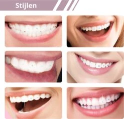 Tooth Gem Kit- TandKristal - DIY- Tandkristallen Set -Tooth Crystal -Cosmetica Serie Winkel 1200x1158 16