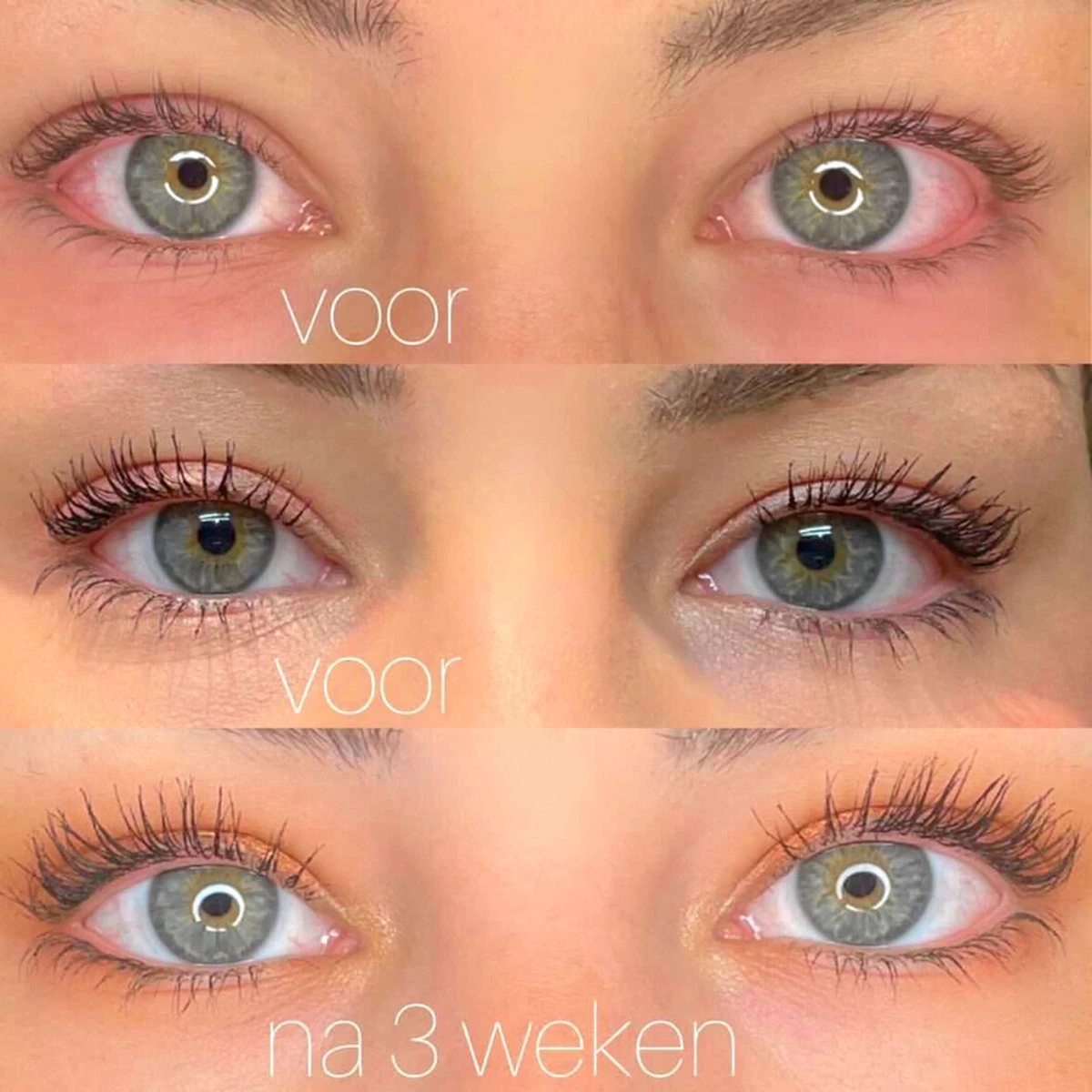 Célie Beauty FLASH - Wimperserum - Binnen 1 Week Zichtbaar Resultaat - 100% Vegan - Wimpergroei - Wimperverzorging - Volle Wimpers - Dikke Wimpers - 3ml - Hydraterend 5 Célie Beauty FLASH - Wimperserum - Binnen 1 Week Zichtbaar Resultaat - 100% Vegan - Wimpergroei - Wimperverzorging - Volle Wimpers - Dikke Wimpers - 3ml - Hydraterend - Afbeelding 3