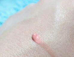 Biodermal Sun Lipbalm SPF25 - Tube 12 Ml - Natural Pink - Lippenbalsem 9 Biodermal Sun Lipbalm SPF25 - Tube 12 Ml - Natural Pink - Lippenbalsem -Cosmetica Serie Winkel 1200x927